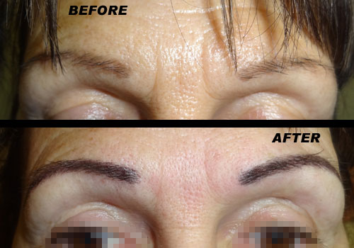 cosmetic tattooing - eyebrows before and after - Cosmetic ...