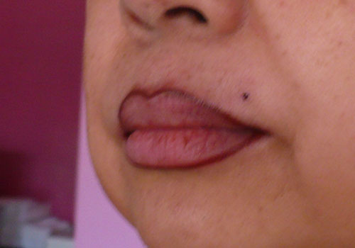 cosmetic tattooing - permanent lipliner - Cosmetic ...