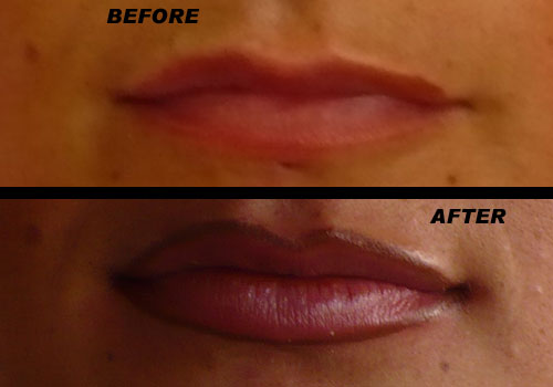 cosmetic tattooing - permanent lipliner - Cosmetic ...